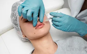 Filler & HydraFacial Bundle
