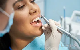 احجز جلسة تنظيف أسنان احترافي واحصل على الثانية مجانًا