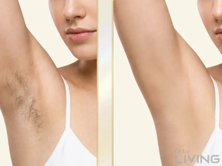 55% Off - Underarm Laser Hair Removal Deal