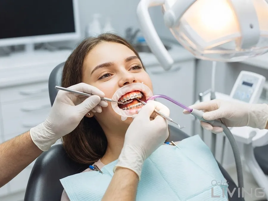 90% Off - Braces Installation Offer