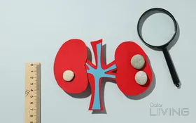 فحص الكلى المتقدم - 330 ريال