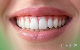 75% Off - Teeth Whitening