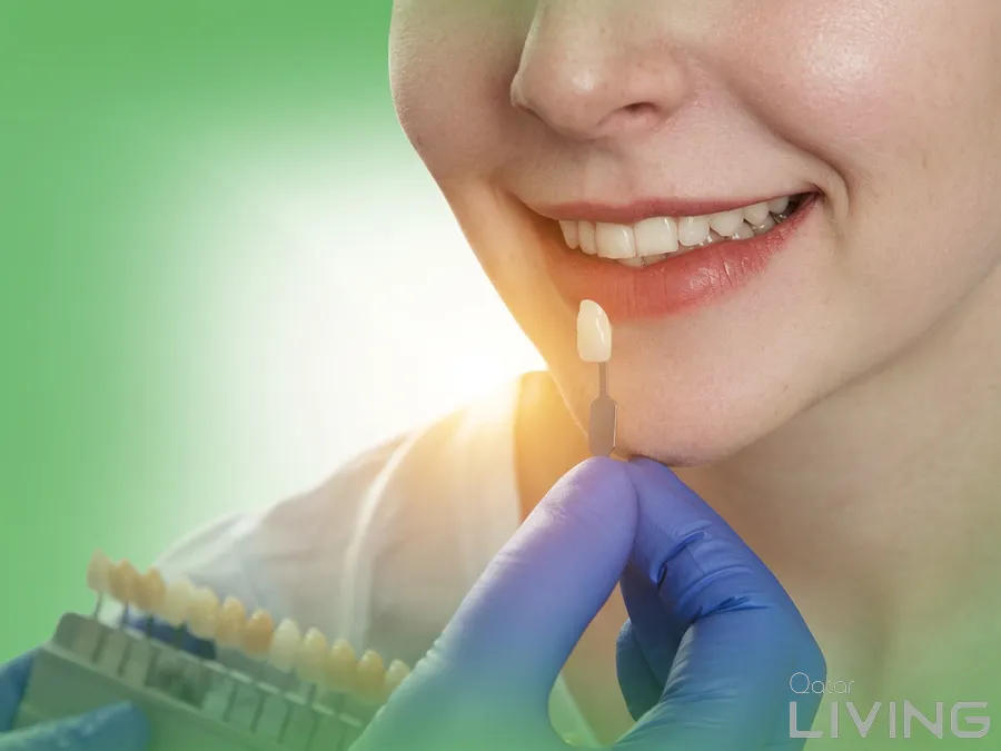77% Off - Emax Veneers