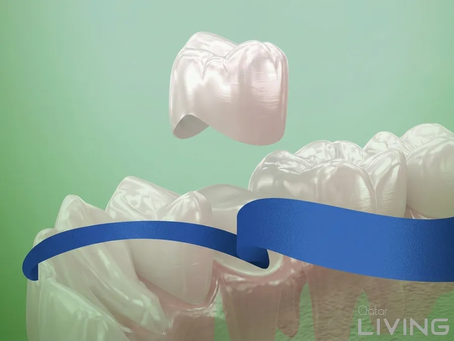 Zirconium Crown (Per Tooth) - 849 QAR