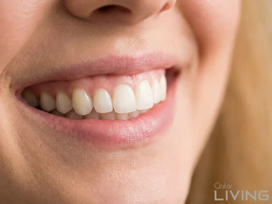 20% Off - Dental Cleaning & Polishing (Simple)