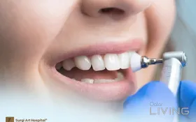 Bright Smile Special – Teeth Cleaning at 66% Off